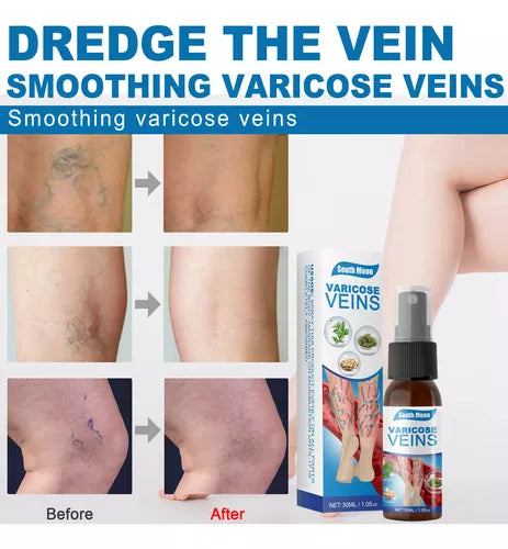 ADIOS VENAS - SPRAY